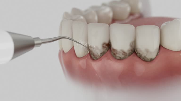 Reliable Dental contractor in Lafayette, IN by Dentist Open Now
